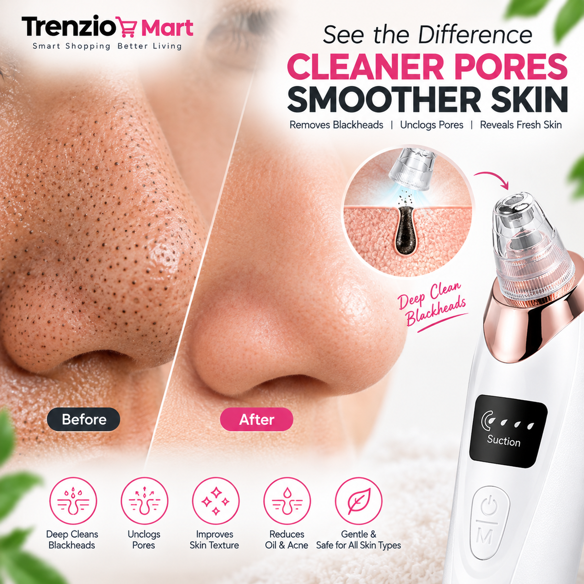 Facial Cleansing Device 5 in 1 Blackhead Remover Machine