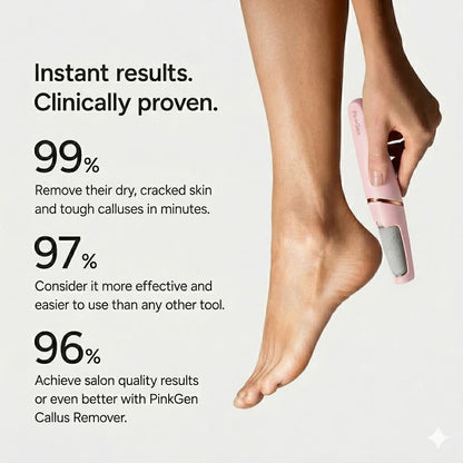 Electric Callus Remover