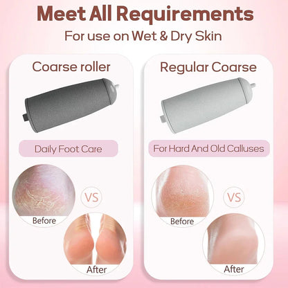 Electric Callus Remover with 2 Roller Heads